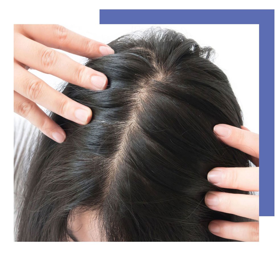 Hair Treatment 1 hair1