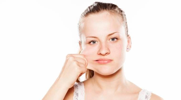 Cheek Implant 4 CHEEK IMPLANT2