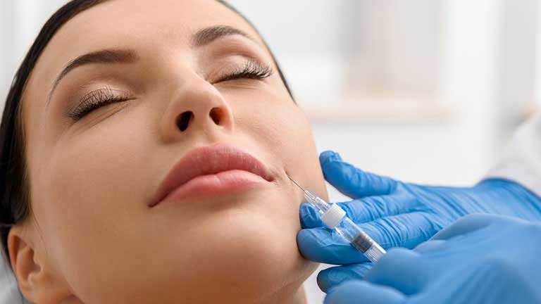 Cheek Implant 3 CHEEK IMPLANT3