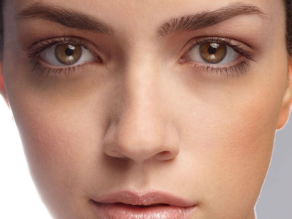 Dark Circles Treatment in islamabad