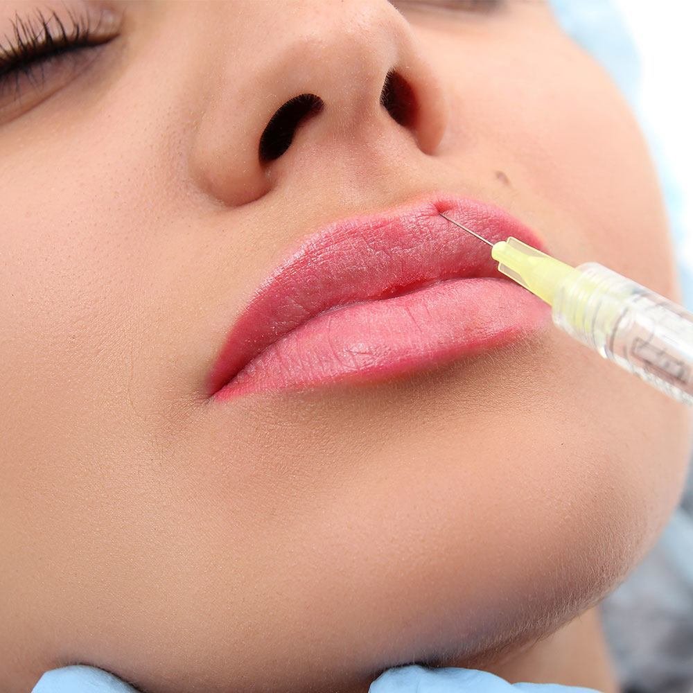 Lip Reduction 3 Lip Reduction Treatment3