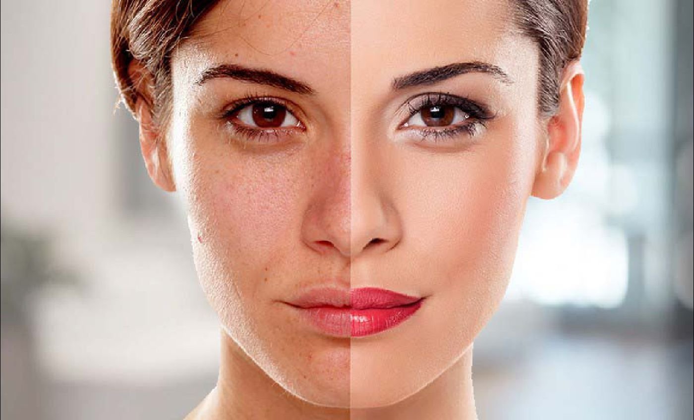 Skin Whitening 1 Skin Whitening Treatment1