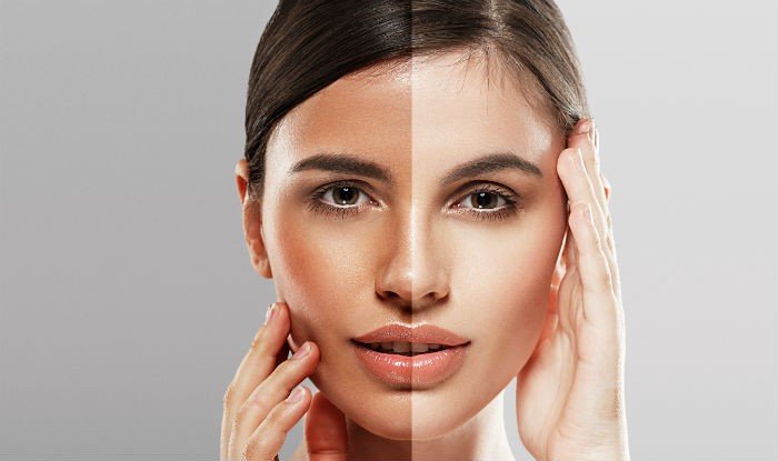 Skin Whitening 3 Skin Whitening Treatment4