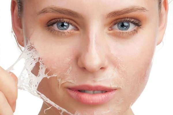 Chemical Skin Peels 2 imatge peeling quimic 600x401 1
