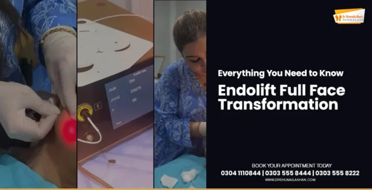 Endolift-Full-Face-Transformation-Cover-Post-by-Dermatologist-Dr.-Shumaila-Khan-in-Islamabad-1024x524